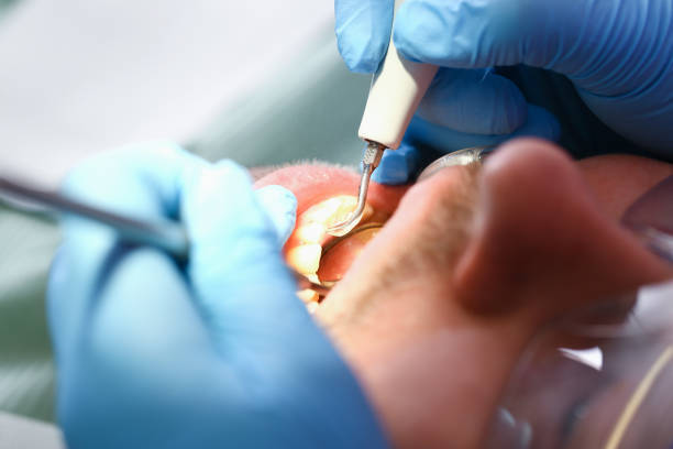 Best Walk-In Emergency Dental Services in East Marion, NY